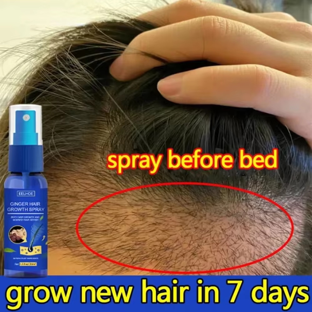Epidermal Growth Factor - Fast Ginger Hair Growth Spray Roots