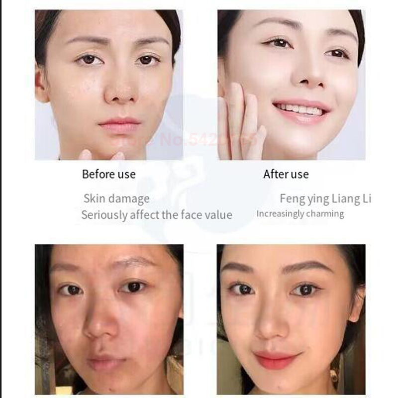 0.25 mm Microneedle GHK-Cu Blu - Epidermal Growth Factor ulasan dan harga