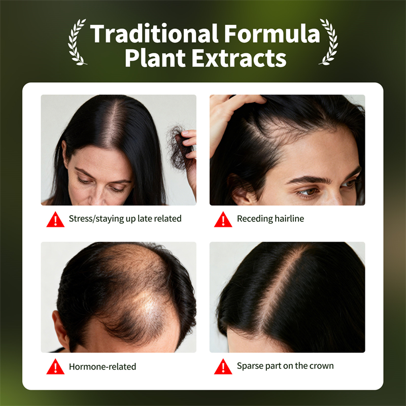 Natural Hair Growth Set Usman  - Epidermal Growth Factor ulasan dan harga