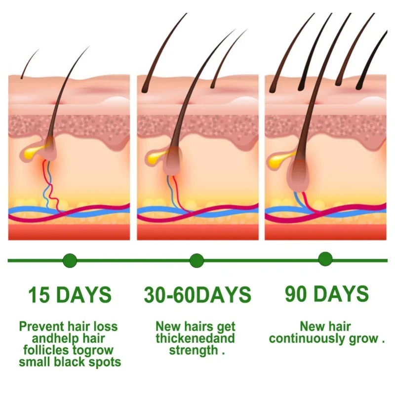 Hair Growth Serum Fast Growing - Epidermal Growth Factor ulasan dan harga