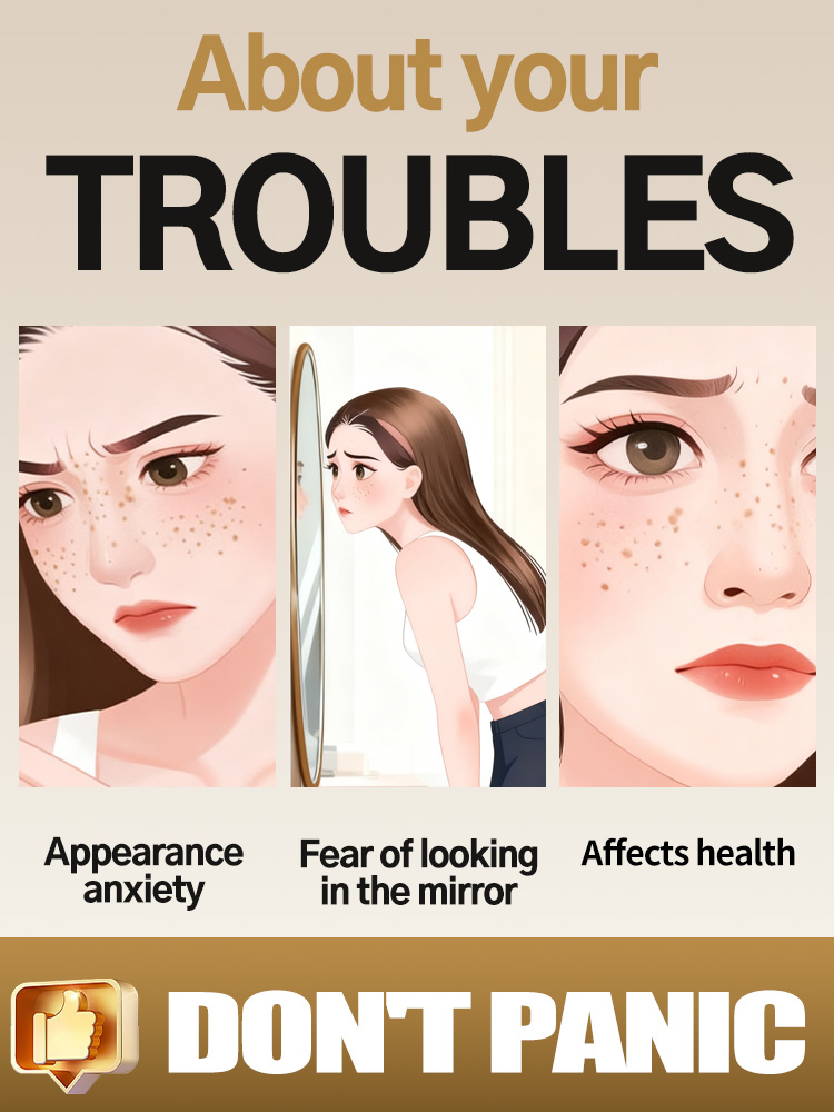 Lightening Facial Freckles Mel - Luxury Skincare Essence ulasan dan harga