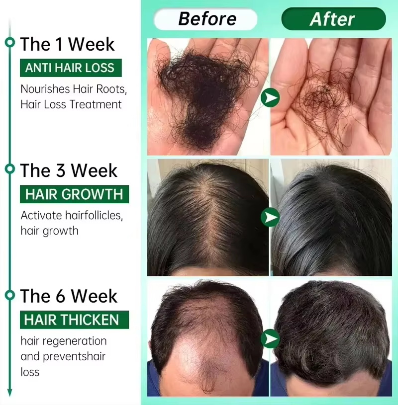 Hair Growth Serum 7 Days Fast  - Epidermal Growth Factor ulasan dan harga