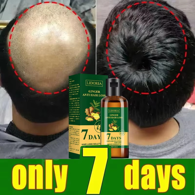 Hair Growth Serum 7 Days Fast  - Epidermal Growth Factor ulasan dan harga