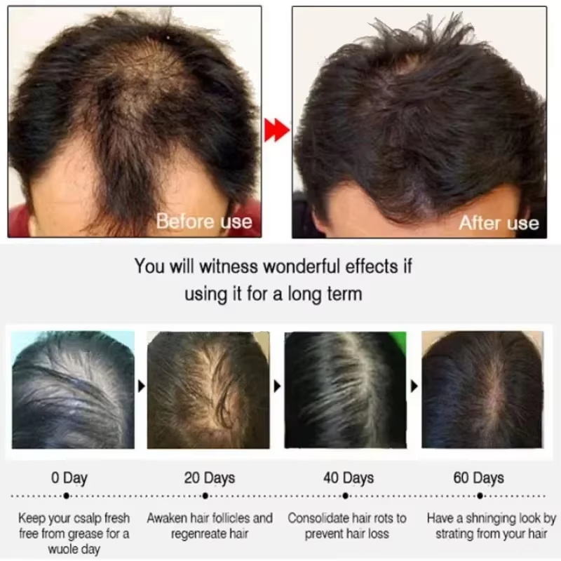 Hair Growth Serum 7 Days Fast  - Epidermal Growth Factor ulasan dan harga