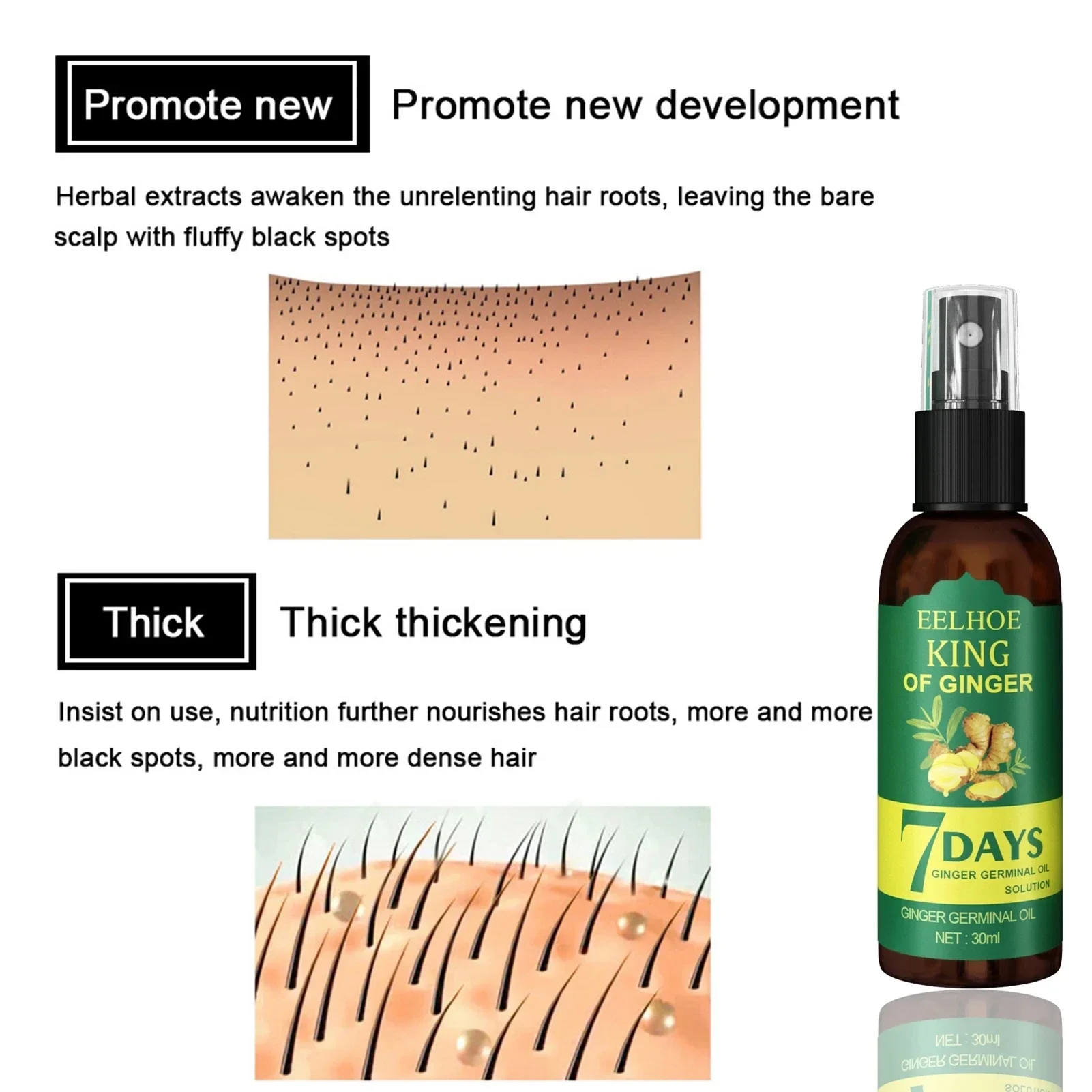 2024 Ginger Hair Growth Serum  - Epidermal Growth Factor ulasan dan harga