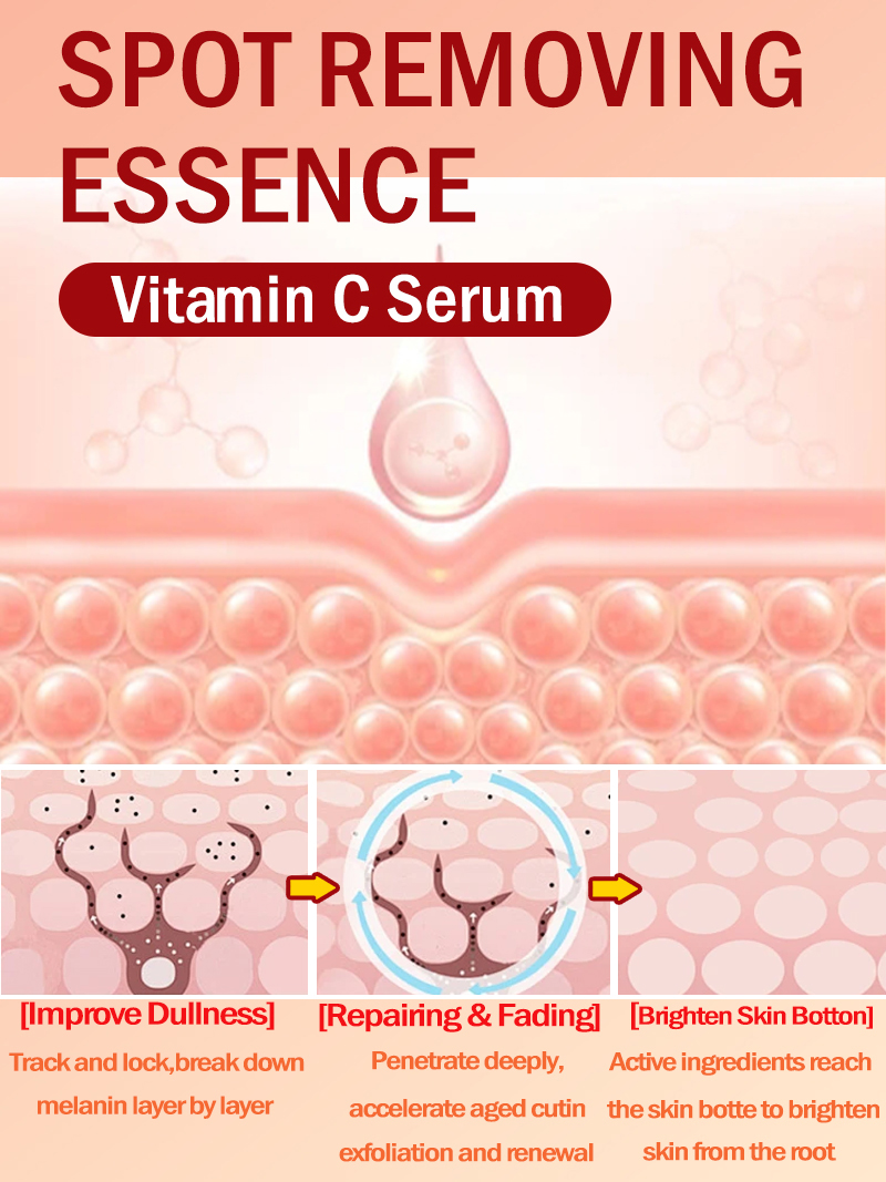 Lighten Freckles Melasma, Faci - Luxury Skincare Essence ulasan dan harga