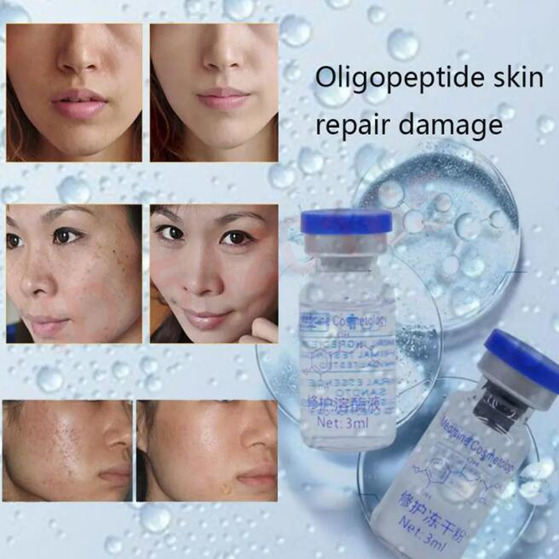 oligopeptide Freeze-dried Powd - Epidermal Growth Factor ulasan dan harga